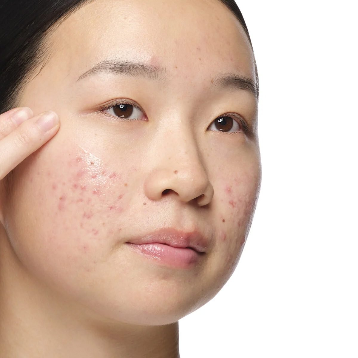The Ordinary – Aloe 2% + NAG 2% Solution - Figura 2